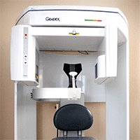 cbct, Cone-Beam CT