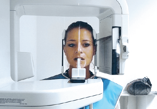 Fogászati röntgenberendezése - röntgenfelvételek