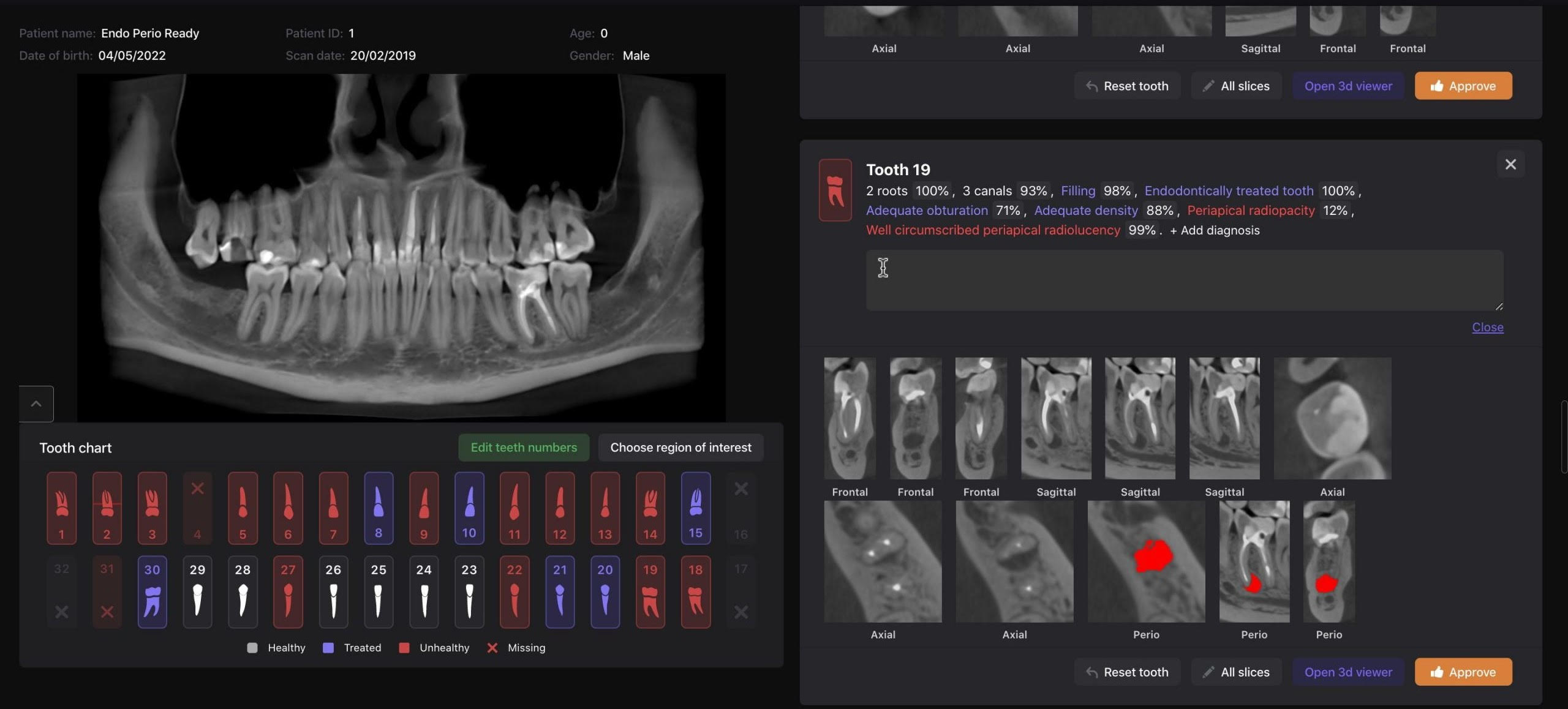MI alkalmazasa radiologiai felvetelek elemzeseben