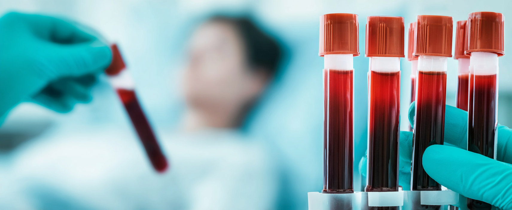 Vérvétel szolgáltatás