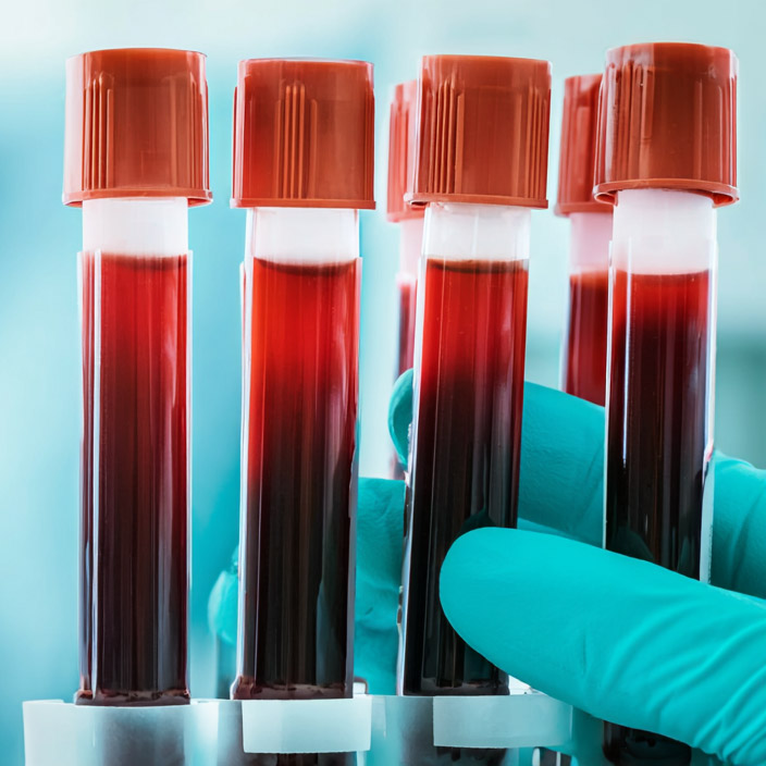 vipdental vervetel02